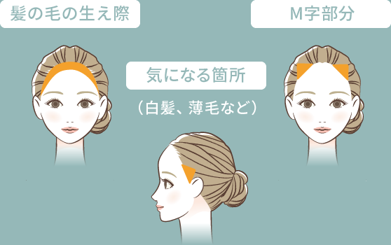 髪の毛の生え際、M字部分、気になる箇所（白髪、薄毛など）