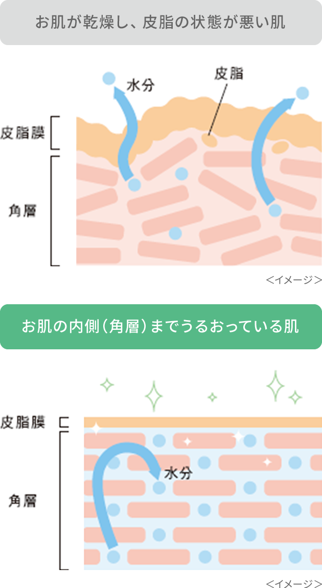 お肌が乾燥し、皮脂の状態が悪い肌。お肌の内側（角層）までうるおっている肌