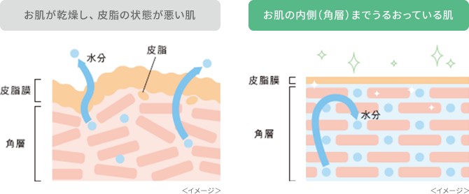 お肌が乾燥し、皮脂の状態が悪い肌。お肌の内側（角層）までうるおっている肌